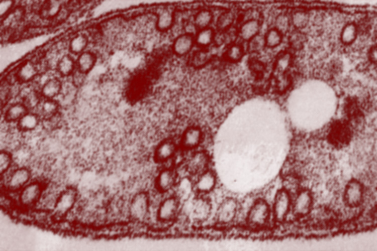 microscope image of rhodobacter sphaeroides